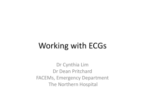 Working with ECGs 1