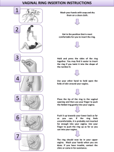 Vaginal Ring Insertion Instructions