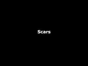 scars - Jonny Diaz