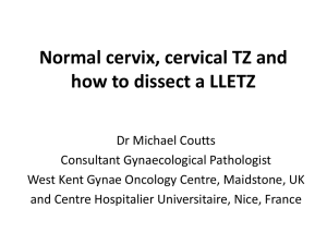 Normal cervix, cervical TZ and how to dissect a LLETZ