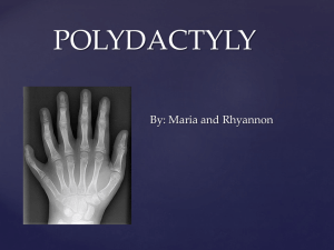 Polydactyly - maria