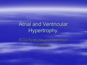 Atrial and Ventricular Hypertrophy.