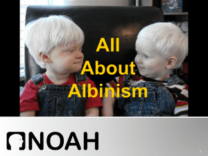 All About Albinism Presentation