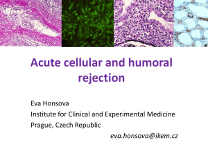 Acute cellular and humoral rejection
