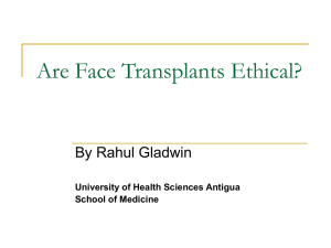 6. Are Face Transplants Ethical?