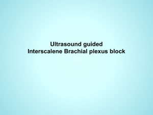 Brachial Plexus block 2 of 2