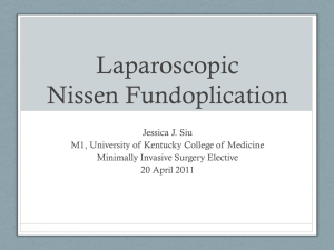 Nissen Fundoplication - University of Kentucky | Medical Center