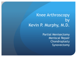 PowerPoint Presentation - Knee Arthroscopy Kevin