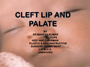 Congenital Defects i:e Cleft lip and cleft patale
