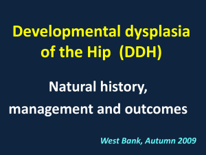 Developmental Dysplasia of the Hip (DDH)