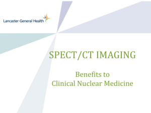 SPECT/CT images - Lancaster General
