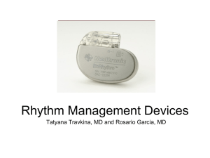 Rhythm management devices