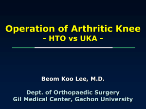 Operation of arthritic knee