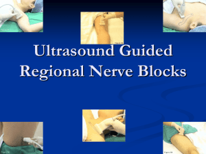Ultrasound Guided Regional Nerve Blocks