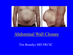 Abdominal Wall Closure