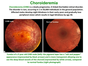 Fundus of a 9 year old CHM male