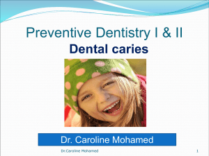 Dental caries - Fresh Men Dentists