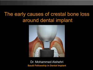 Causes of Crestal Bone Loss Adjacent to implants