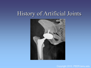 History of Artificial Joints