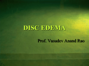 disc odema - M.M.Joshi Eye Institute