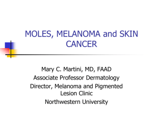 Moles and Melanoma