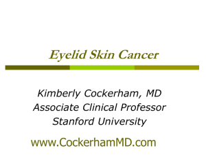 eyelid cancer update - Kimberly Cockerham, MD