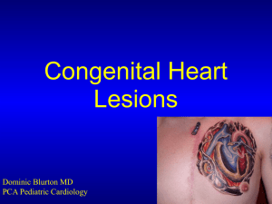 Congenital-Heart-Lesions-Miller-PICU-RN