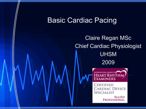 Basic Cardiac Pacing