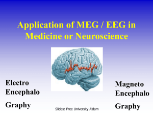 Application of MEG in Neuroscience