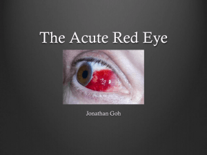 The Acute Red Eye