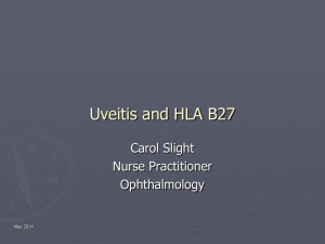 Uveitis and HLA B27 - Ophthalmic Nurses of NZ