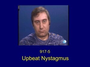 Upbeat Nystagmus