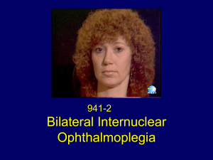 Bilateral Internuclear Ophthalmoplegia (novel.utah.edu)