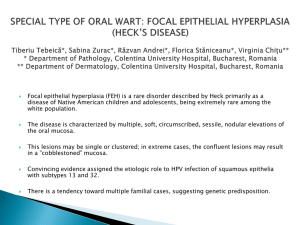Focal Epithelial Hyperplasia (Heck`s Disease)