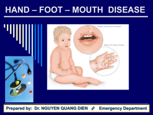hand – foot – mouth disease