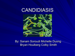 Candidiasis - UCLA Oral Medicine