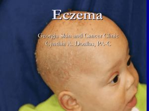 Eczema “The boiling over of the skin”