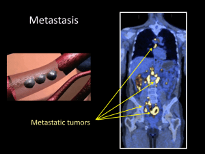 Metastasis powerpoint