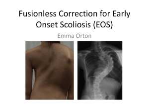 Fusionless Correction fro Early Onset Scoliosis (EOS)