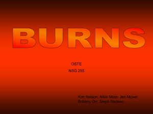 OSTE burns