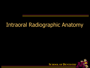 2 Intraoral Radiographic Anatomy