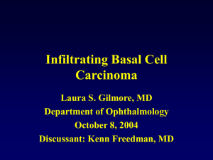 Infiltrating Basal Cell Carcinoma