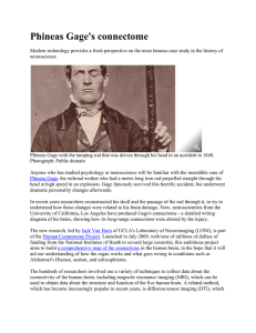 Phineas Gage with the tamping rod that was driven through his head