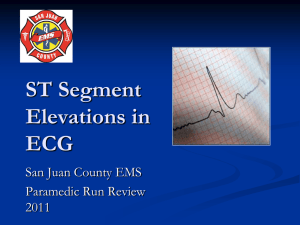 ST Segment Elevations in ECG