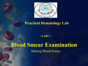 I- Preparation Of Blood Smear