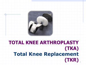 Knee Biomechanics & Total Knee Arthroplasty