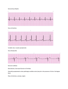 Abnormal EKG study guide comp