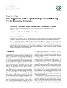 Research Article Noise Suppression in ECG Signals through Efficient One-Step