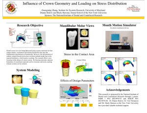 Influence of Crown Geometry and Loading on Stress Distribution