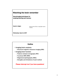 Watching the brain remember Outline • Imaging brain anatomy • Imaging brain function
